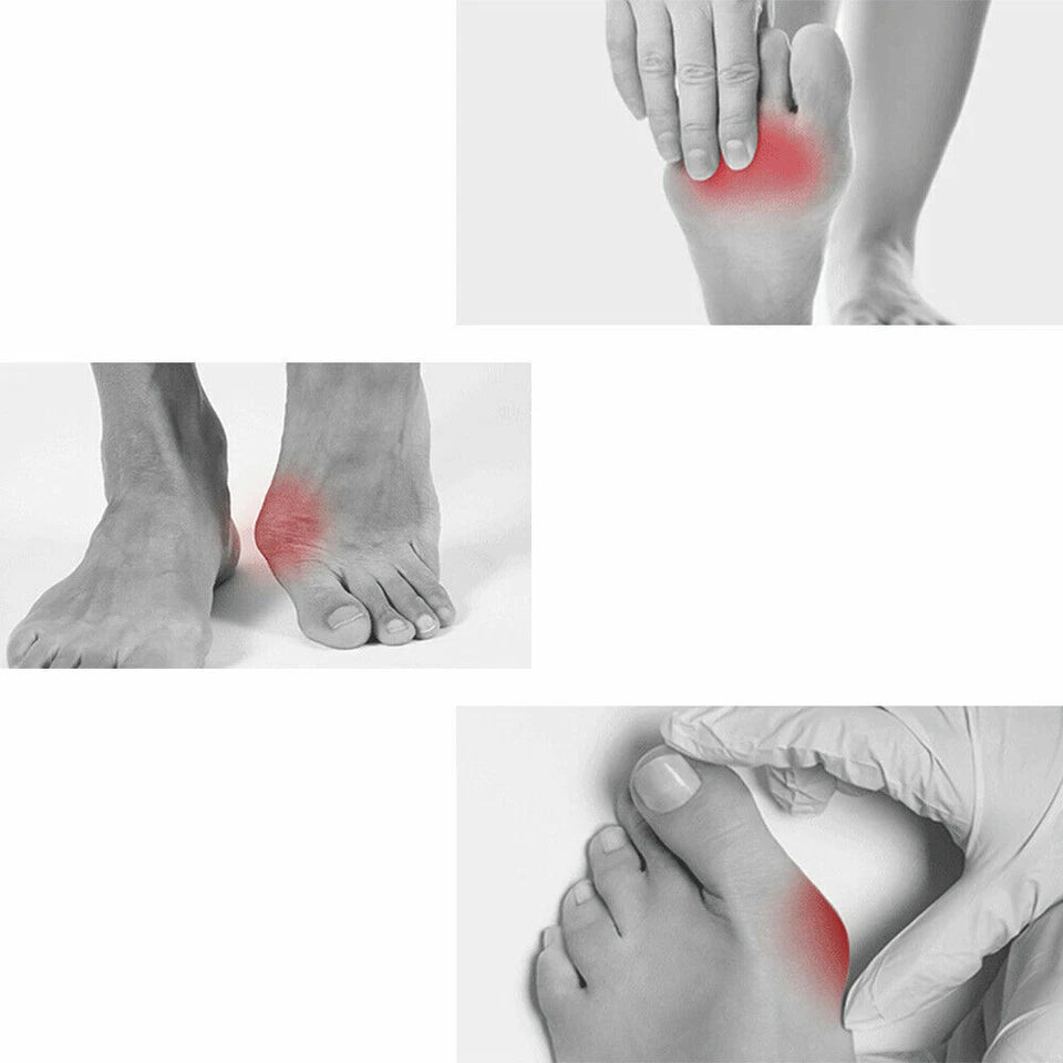 Gel Silicone Toe Spacers Kit - 12 pieces