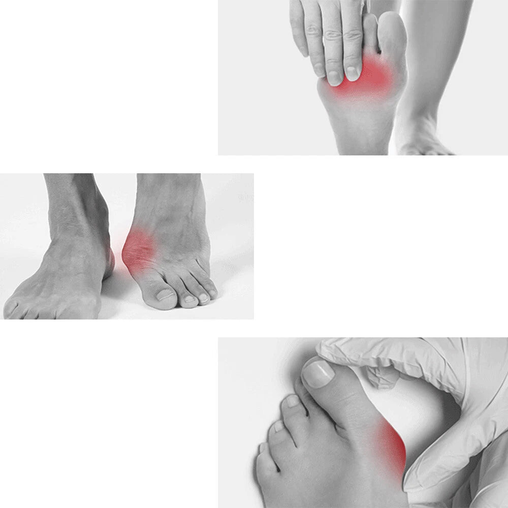 Gel Silicone Toe Spacers Kit - 12 pieces