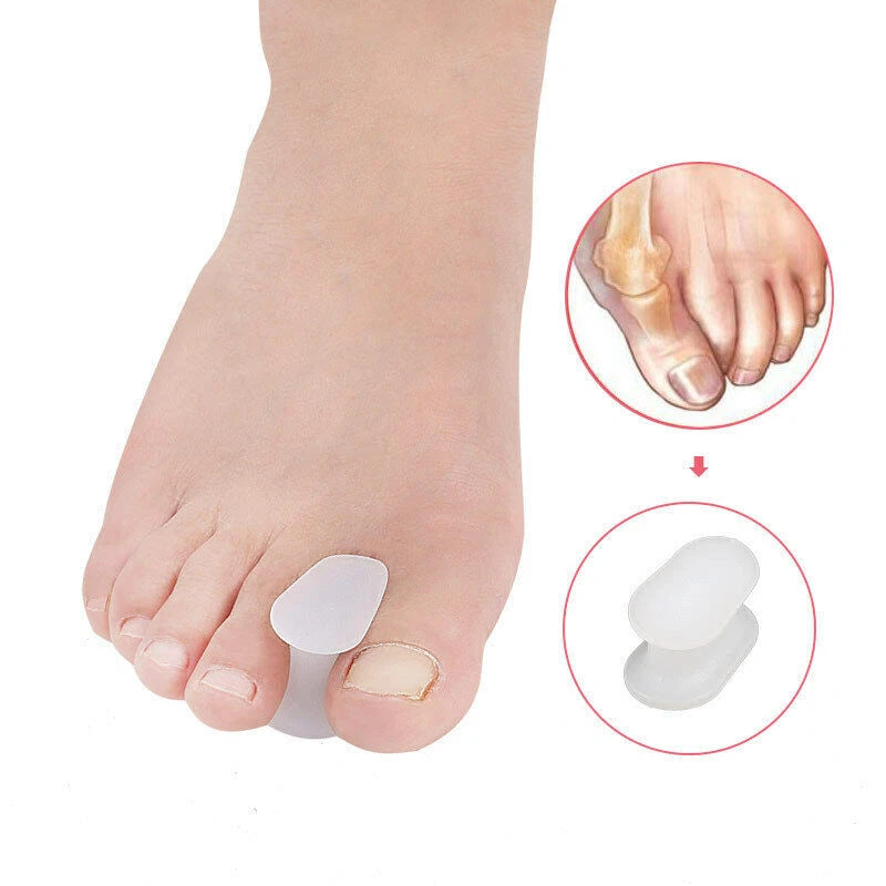 Gel Silicone Toe Spacers Kit - 12 pieces