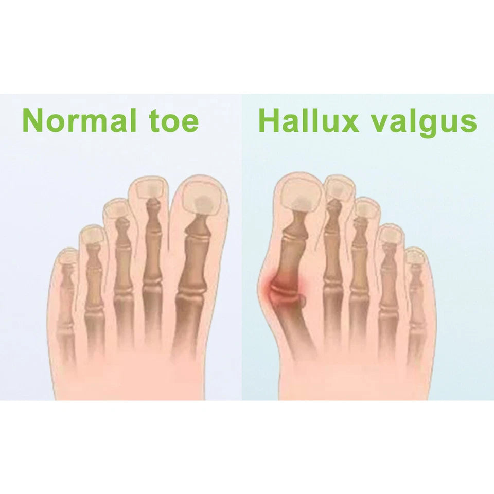 Gel Silicone Toe Spacers Kit - 12 pieces